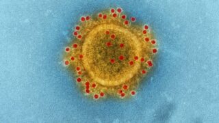 Ebola : plus de 24 000 dossiers d’immigration pourraient être suspendus par le Canada
